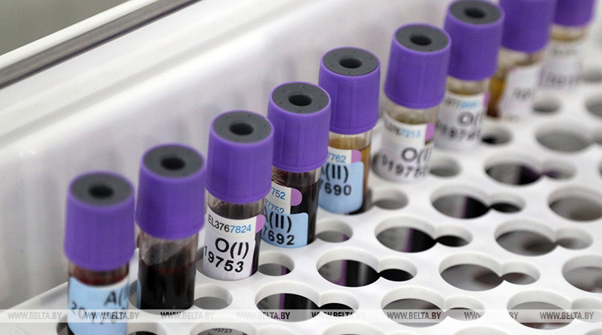 Пиневич: в Беларуси все тяжелые случаи COVID-19 наблюдаются у непривитых пациентов