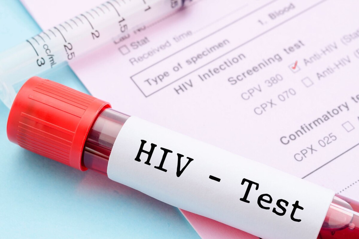 Преодолевая трудности, измени стратегию. 1 декабря – Всемирный день профилактики ВИЧ-инфекции